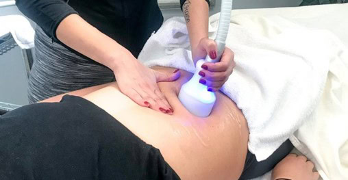 Cryo Slimming