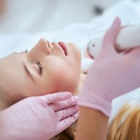 microneedling
